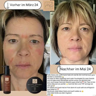 BIO-Body & Tattoo-Mousse sensitive Aloe mit Hyaluron 200ml Naturkosmetik - VITALOVE - Naturprodukte