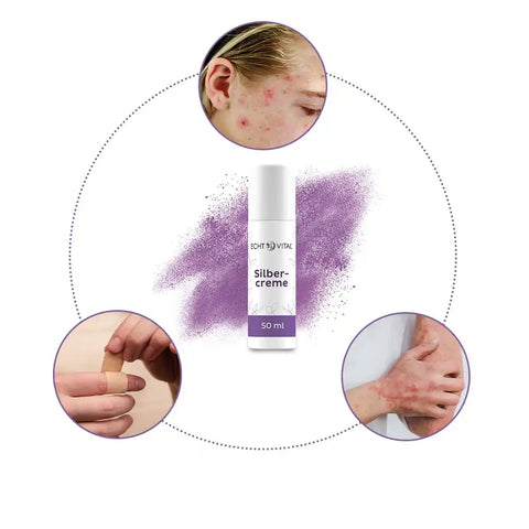 Echt Vital Silbercreme 50 ml, Anwendung bei Akne, Wunden und Hautirritationen